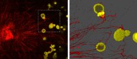 sensory nerve sends processes to contact cancer organoids in a petri dish